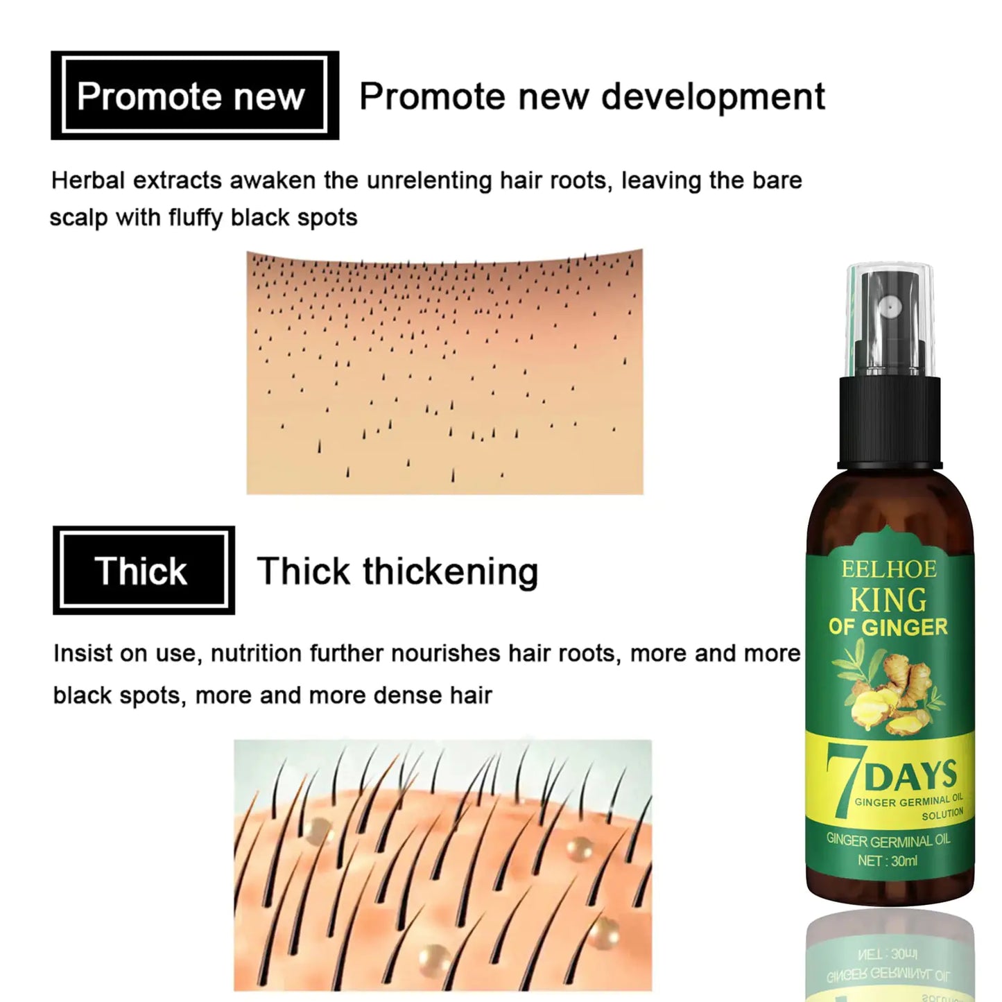 Ginger Hair Growth Serum Sprayer Hair Regrowth