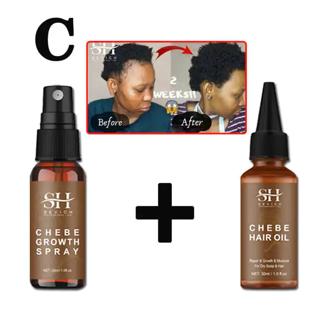 Alopecia Treatment Oil Natural Crazy Hair Regrowth